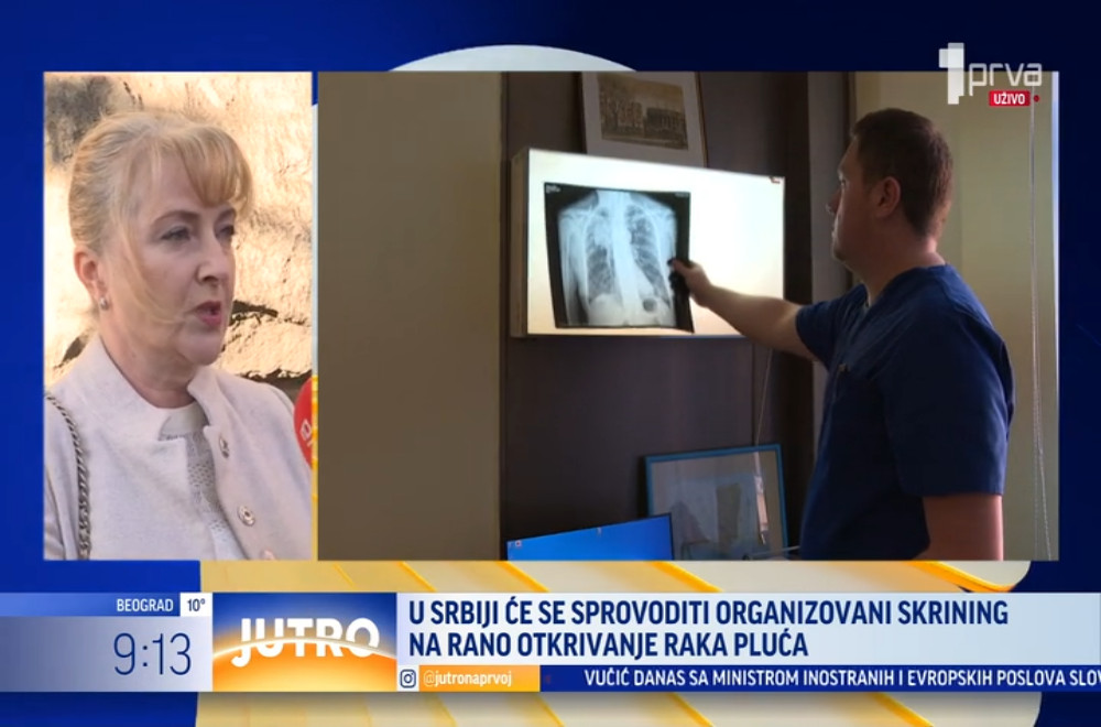 U Srbiji će se sprovoditi ogranizovani skrining na rano otkrivanje raka pluća